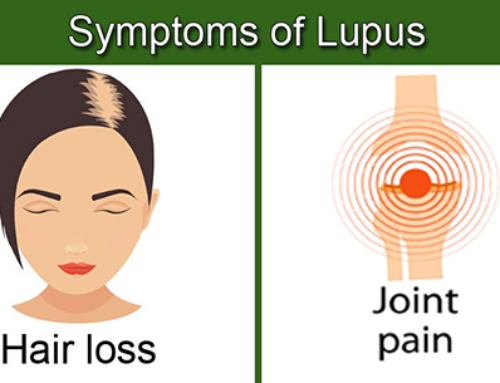 Symptoms of Lupus